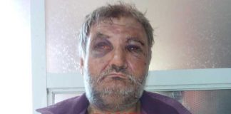 Боят оставя сляп с едното око 47-годишния Николай Данаилов от Дупница, полицията диша във врата на биячите