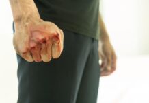 Син преби баща си в Усойка, глобиха го с 306.78 евро Син преби баща си в Усойка